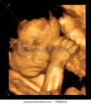 A live baby in a womb